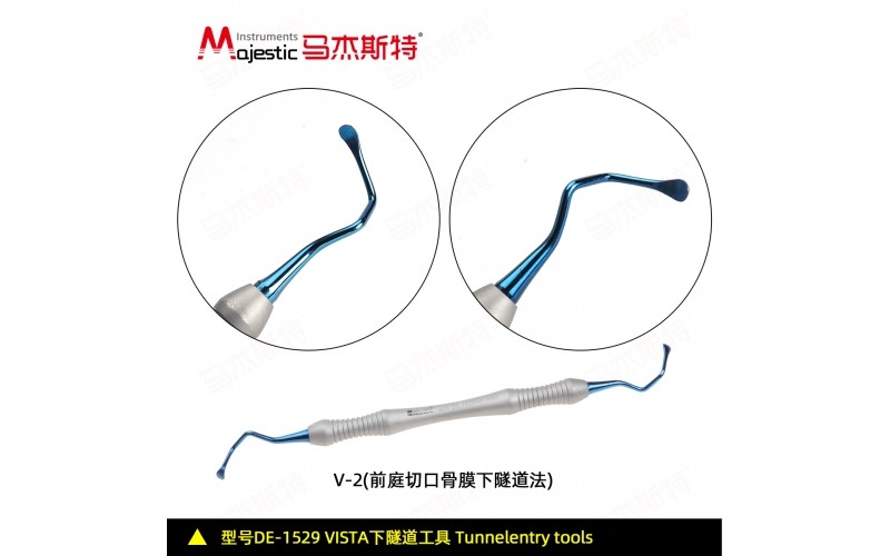 Vestibular Incision Subperiosteal Tunnel Access V-2